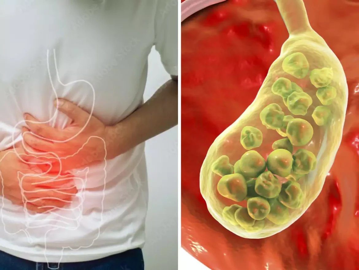 Gall Bladder Stones का दर्द 7 दिनों में गायब करें, बस अपनाएं ये आसान घरेलू उपाय
