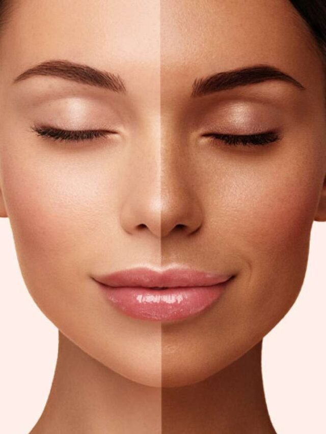 These measures will be helpful in reducing skin tanning