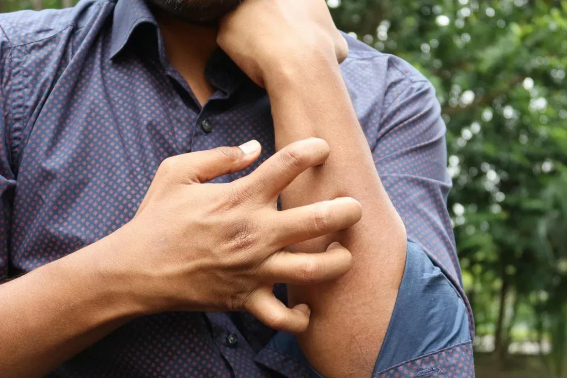 मानसून में स्किन Infection की समस्या हो गई है? तो अपनाएं ये असरदार घरेलू नुस्खे।