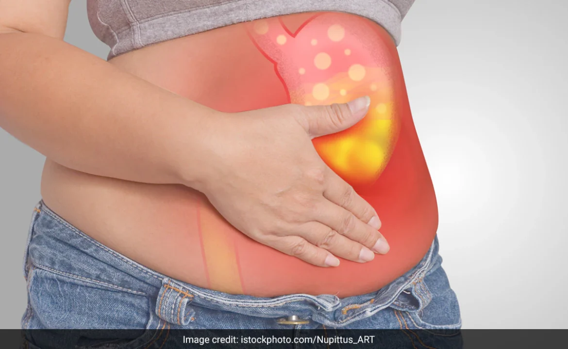 Often Flatulence केवल गैस की समस्या नहीं होती, यह 4 गंभीर बीमारियों का संकेत भी हो सकता है।