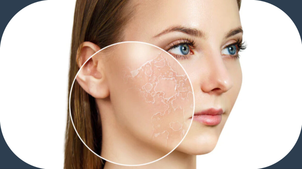 स्किन डिहाइड्रेशन के शुरुआती संकेत: सही हाइड्रेशन से स्किन को कैसे रखें हेल्दी?