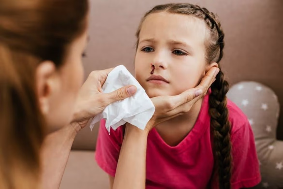 Nose Bleeding in Summer: गर्मियों में नाक से खून आना आम या चेतावनी का संकेत?
