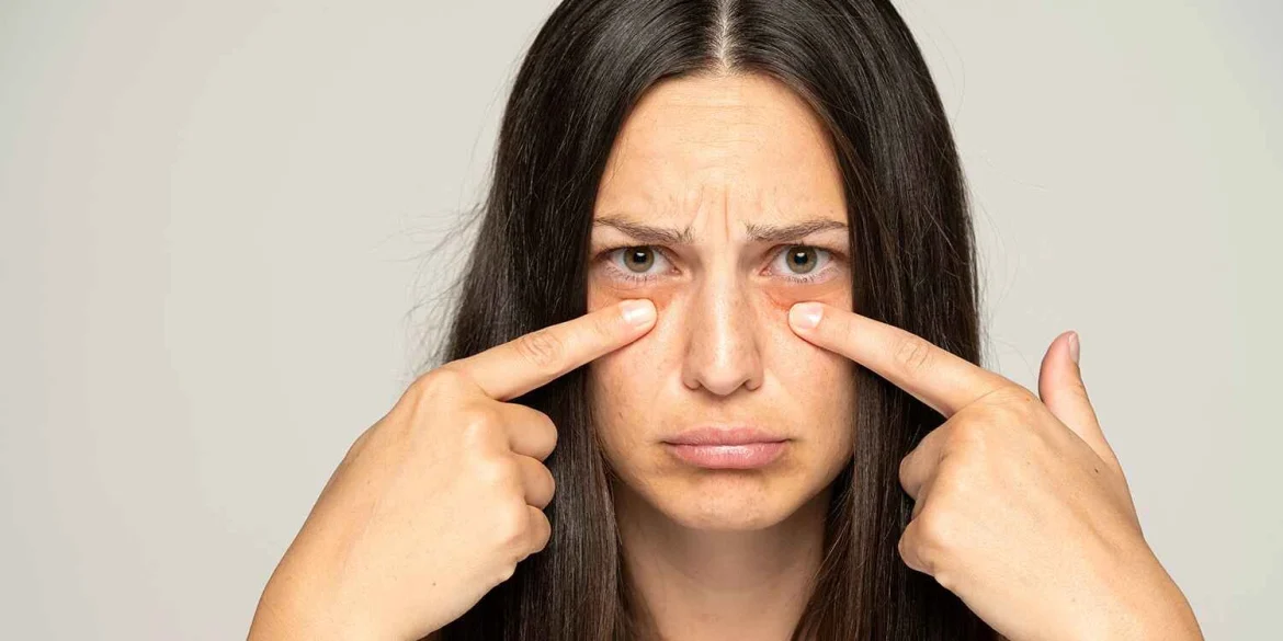 Eye Care Tips: आंखों के नीचे सूजन और डार्क सर्कल क्यों बढ़ते हैं? जानें कारण और बचाव के आसान उपाय