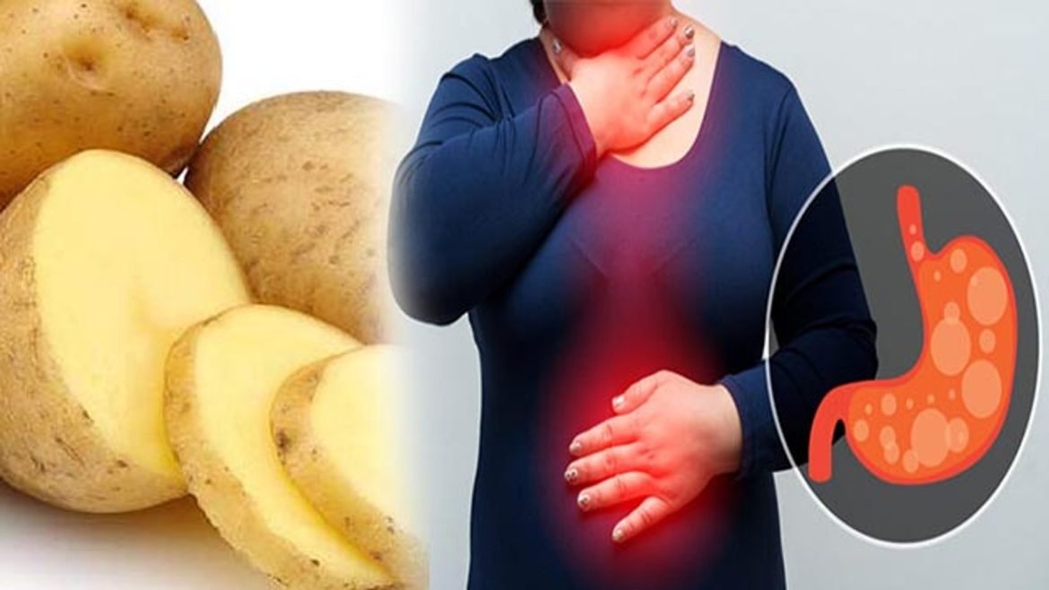 Potatoes Cause Acidity: क्या आलू खाने से बढ़ती है एसिडिटी? जानें कारण और सही सेवन का तरीका
